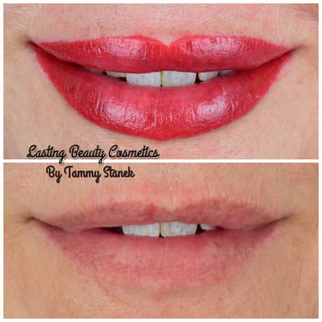 Lips Treatment Tammy Stanek
