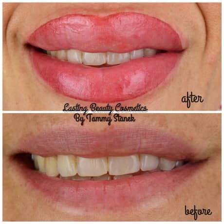 Lips Blush Treatment