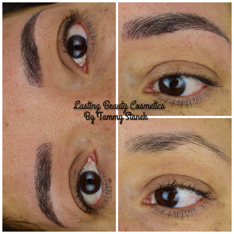 Microbalding Eyebrows Treatment